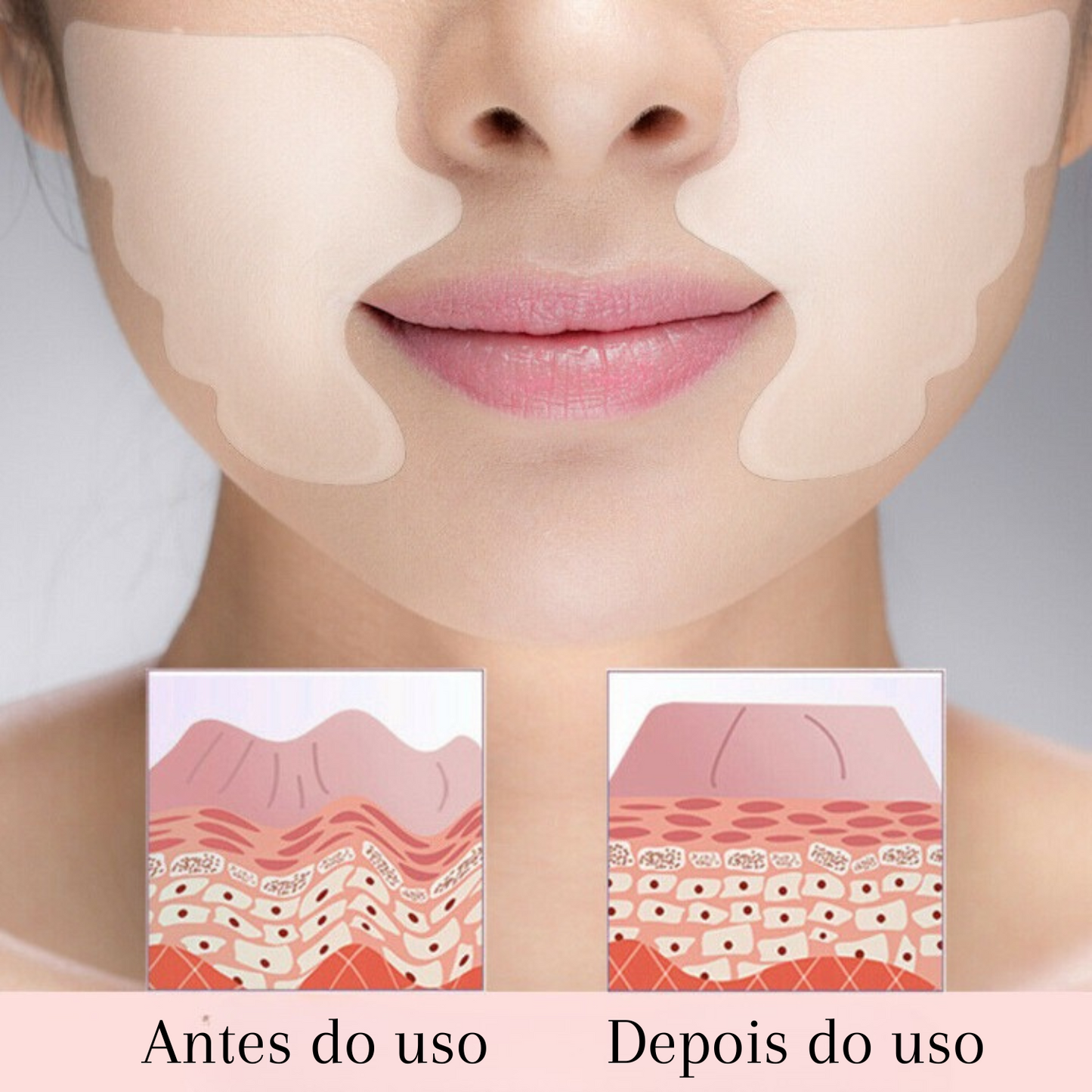 Adesivos Antirrugas Pro.Botox®