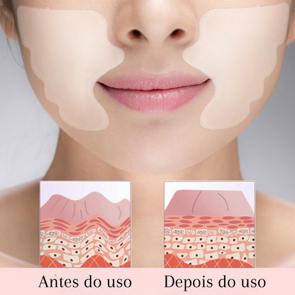 Adesivos Antirrugas Pro.Botox®